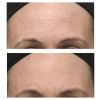 Dr Dennis Gross Alpha Beta Ultra Gentle Peel (30 Pack) thumbnail 2