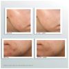 Murad Outsmart Blemish Clarifying Treatment 50ml thumbnail 3