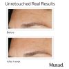Murad Replenishing Multi-Acid Peel 100ml thumbnail 4