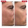 Dr. Levy Booster Serum 30ml thumbnail 5