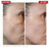 Dr. Levy Radical3 Reboot Pro Peel 50ml thumbnail 5
