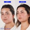Fresh Floral Recovery Calming Mask 100ml thumbnail 9