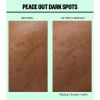 Peace Out Peace Out Dark Spots thumbnail 3