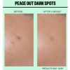 Peace Out Peace Out Dark Spots thumbnail 4
