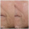 Shani Darden Skin Care Facial Sculpting Wand thumbnail 5