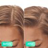The INKEY List Salicylic Acid Exfoliating Scalp Treatment 150ml thumbnail 9