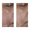 Perricone MD Intensive Pore Minimizing Toner thumbnail 3