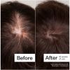 Act+Acre 3% Stem Cell Peptide H3-Grow+ Complex Scalp Treatment For Hair Thinning and Growth 89ml thumbnail 5