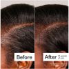 Act+Acre 3% Stem Cell Peptide H3-Grow+ Complex Scalp Treatment For Hair Thinning and Growth 89ml thumbnail 9