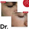 Dr. LEVY Switzerland Booster Serum 30ml thumbnail 6