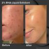 Paula's Choice Multi-Level Exfoliation Set thumbnail 4