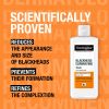 Neutrogena Blackhead Eliminating puhdistava kasvovesi mustapäihin 200 ml thumbnail 5